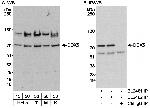 DDX5 Antibody in Western Blot (WB)