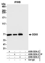 DDX5 Antibody in Immunoprecipitation (IP)