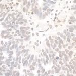 REST Antibody in Immunohistochemistry (Paraffin) (IHC (P))