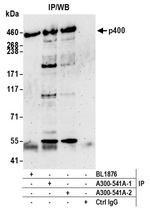 p400 Antibody in Immunoprecipitation (IP)