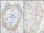 NMI Antibody in Immunohistochemistry (Paraffin) (IHC (P))