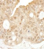 SYK Antibody in Immunohistochemistry (Paraffin) (IHC (P))