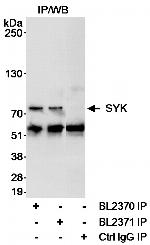 SYK Antibody in Immunoprecipitation (IP)