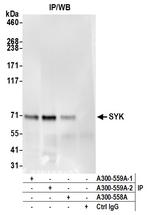 SYK Antibody in Immunoprecipitation (IP)