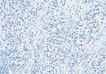 RIF1 Antibody in Immunohistochemistry (Paraffin) (IHC (P))