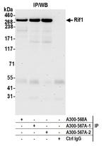 RIF1 Antibody in Immunoprecipitation (IP)