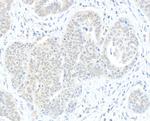 RIF1 Antibody in Immunohistochemistry (Paraffin) (IHC (P))