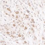 RIF1 Antibody in Immunohistochemistry (Paraffin) (IHC (P))