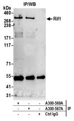 RIF1 Antibody in Immunoprecipitation (IP)