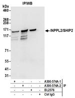 INPPL1/SHIP2 Antibody in Immunoprecipitation (IP)