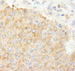 NF2 Antibody in Immunohistochemistry (Paraffin) (IHC (P))