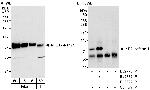 NF2 Antibody in Western Blot (WB)