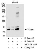 WASP Antibody in Immunoprecipitation (IP)