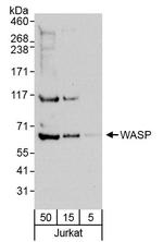 WASP Antibody in Western Blot (WB)