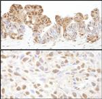 VCP Antibody in Immunohistochemistry (Paraffin) (IHC (P))