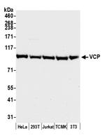 VCP Antibody in Western Blot (WB)