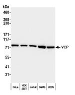 VCP Antibody in Western Blot (WB)