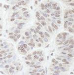 GNL3 Antibody in Immunohistochemistry (Paraffin) (IHC (P))