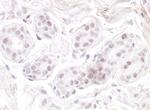 GNL3 Antibody in Immunohistochemistry (Paraffin) (IHC (P))