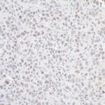 GNL3 Antibody in Immunohistochemistry (Paraffin) (IHC (P))