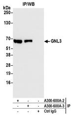 GNL3 Antibody in Immunoprecipitation (IP)