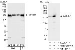 CAP-D2 Antibody in Western Blot (WB)