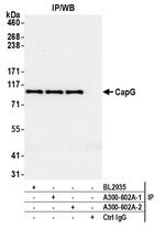 CAP-G Antibody in Immunoprecipitation (IP)