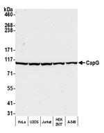 CAP-G Antibody in Western Blot (WB)