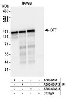 BTF Antibody in Immunoprecipitation (IP)