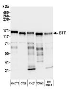 BTF Antibody in Western Blot (WB)