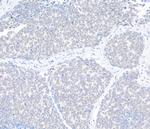 SKIV2L2 Antibody in Immunohistochemistry (Paraffin) (IHC (P))