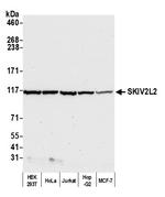 SKIV2L2 Antibody in Western Blot (WB)