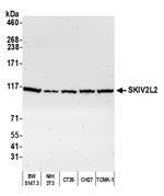 SKIV2L2 Antibody in Western Blot (WB)