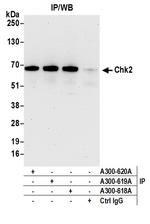 Chk2 Antibody in Immunoprecipitation (IP)