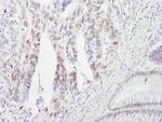 Chk2 Antibody in Immunohistochemistry (Paraffin) (IHC (P))