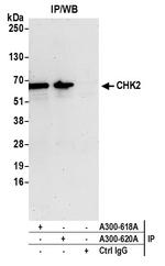 Chk2 Antibody in Immunoprecipitation (IP)