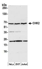 Chk2 Antibody in Western Blot (WB)