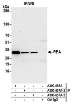 REA Antibody in Immunoprecipitation (IP)