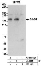 ErbB4 Antibody in Immunoprecipitation (IP)