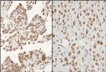 hnRNP-K Antibody in Immunohistochemistry (Paraffin) (IHC (P))