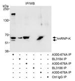 hnRNP-K Antibody in Immunoprecipitation (IP)