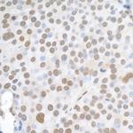 hnRNP-K Antibody in Immunohistochemistry (Paraffin) (IHC (P))