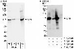 Sirt1 Antibody in Western Blot (WB)