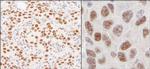 hnRNP-U Antibody in Immunohistochemistry (Paraffin) (IHC (P))