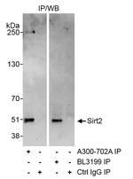 Sirt2 Antibody in Immunoprecipitation (IP)