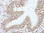 4E-T/eIF4E-T Antibody in Immunohistochemistry (Paraffin) (IHC (P))