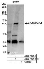 4E-T/eIF4E-T Antibody in Immunoprecipitation (IP)