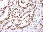 Nucleolin/NCL Antibody in Immunohistochemistry (Paraffin) (IHC (P))