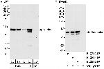 Nucleolin/NCL Antibody in Western Blot (WB)