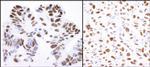 Nucleolin/NCL Antibody in Immunohistochemistry (Paraffin) (IHC (P))